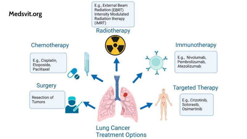 Examination of Therapeutic Paradigms for Lung Cancer in Young Adults