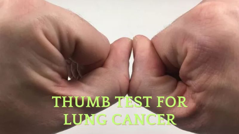 Thumb Test for Lung Cancer