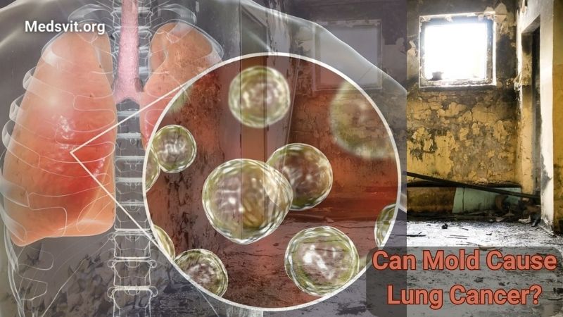 Can Mold Cause Lung Cancer? The Relationship Between Mold Exposure and Lung Cancer Risk
