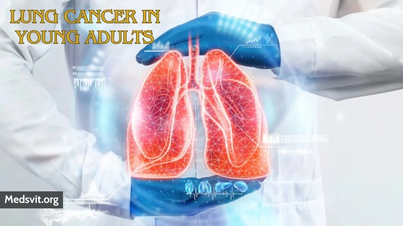 Understanding Lung Cancer in Young Adults: Risks, Symptoms, Diagnosis, and Treatment