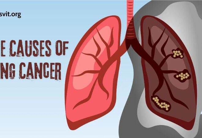 Understanding the Causes of Lung Cancer: A Comprehensive Overview